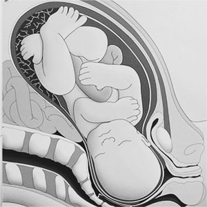 geburts vorbereitungs kurs bild